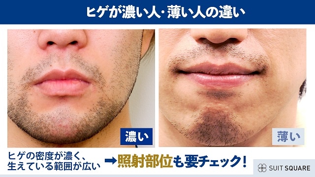 ヒゲの濃さの違い