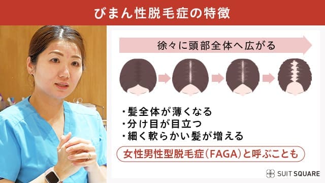 びまん性脱毛症の特徴