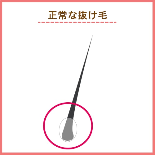 正常な抜け毛