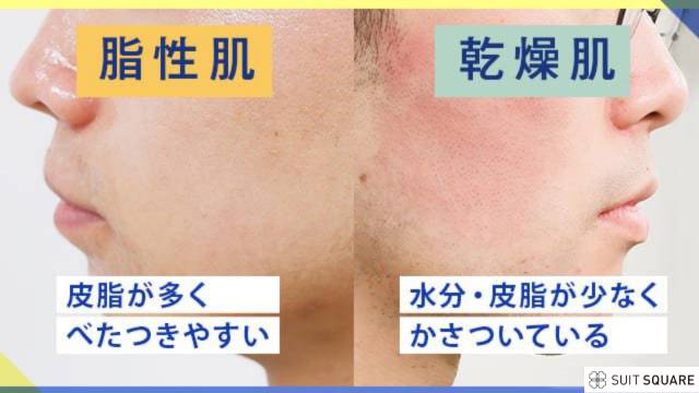 テカリ肌、乾燥肌の男性