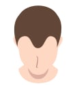 AGA男性の毛髪イラスト