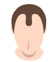 AGA男性の毛髪イラスト