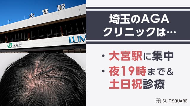 埼玉県大宮駅前とAGA男性の頭皮