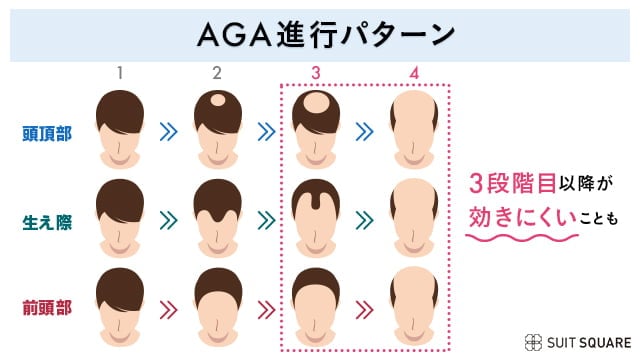 症状が進むにつれて効果を実感しにくいことを表すイラスト