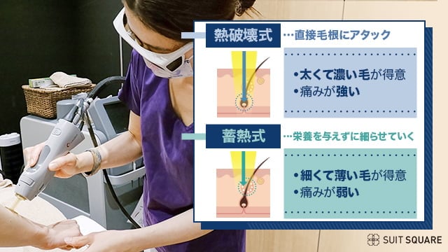 熱破壊式脱毛器と蓄熱式脱毛器の違い