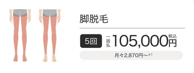 エミナルクリニックメンズ（メンズエミナル）の脚脱毛プラン