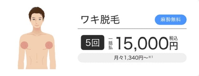 エミナルクリニックメンズ（メンズエミナル）のワキ脱毛プラン