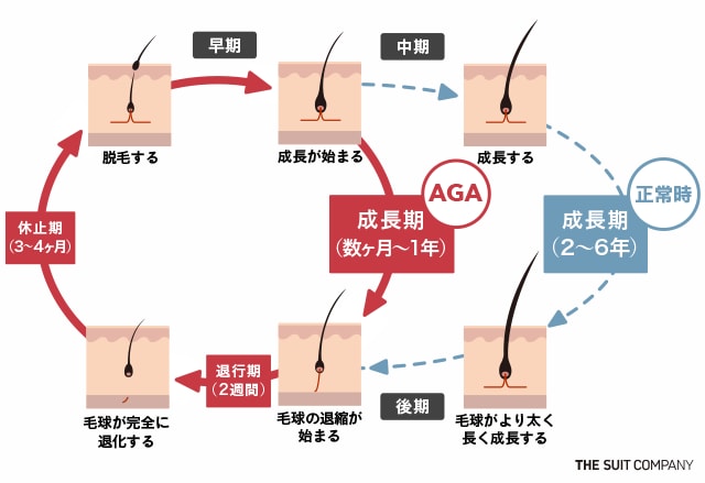 AGAのヘアサイクルを表したイラスト