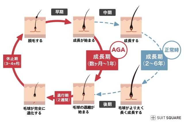 ヘアサイクルとAGA（男性型脱毛症）の関係図